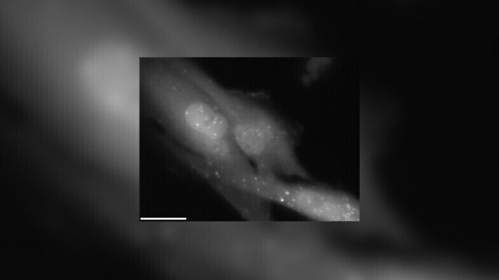 Радиационное отравление, страшная авария и судьба Хисаши Оучи — самого радиоактивного человека в мире