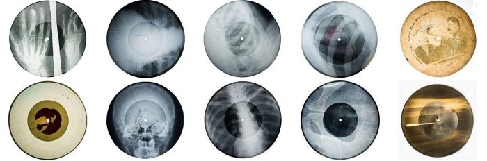 Музыка на костях: как советские подпольщики победили цензуру с помощью рентгена