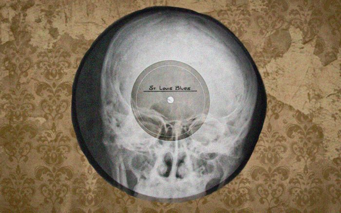 Музыка на костях: как советские подпольщики победили цензуру с помощью рентгена