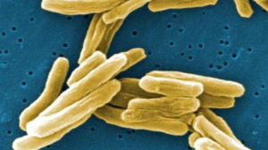 Почему мы до сих пор не победили туберкулез? В МФТИ рассказали, где и как искать новые антибиотики