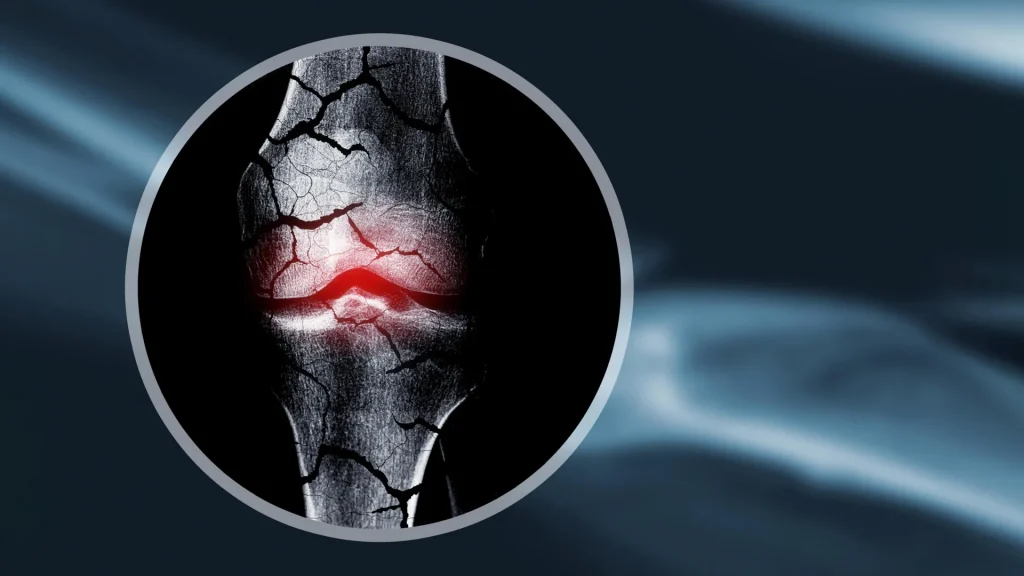 Бесклеточный хрящевой каркас помогает восстанавливать костную ткань