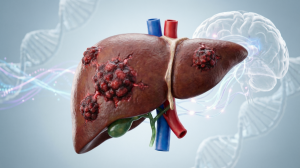 Искусственный интеллект против рака: ученые создадут клеточную 3D-модель опухоли печени