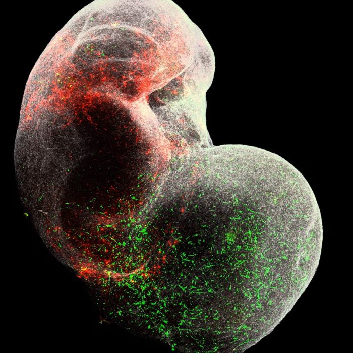 Органоиды мозга: как «мини-мозги» меняют науку — и заставляют задуматься об этике