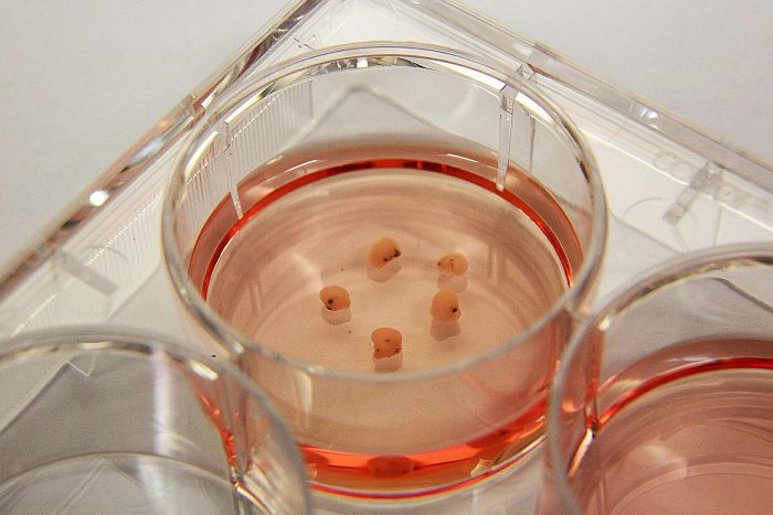 Органоиды мозга: как «мини-мозги» меняют науку — и заставляют задуматься об этике