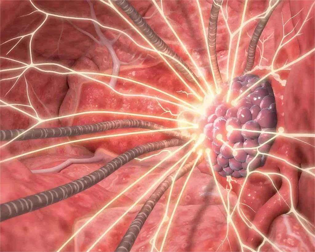 Тяжелые ионы против рака: агрессивные опухоли уничтожат без повреждения здоровых тканей